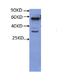 RS1 | Salt stress root protein RS1 in the group Plant/Algal Antibodies / Environmental Stress / Salt stress at Agrisera AB (Antibodies for research) (AS16 3833)